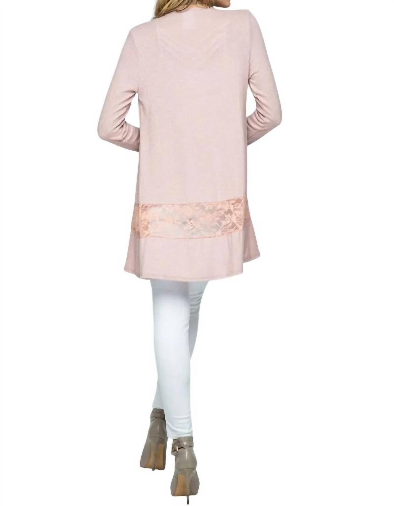 Vocal Apparel - Cardigan With Lace Detail